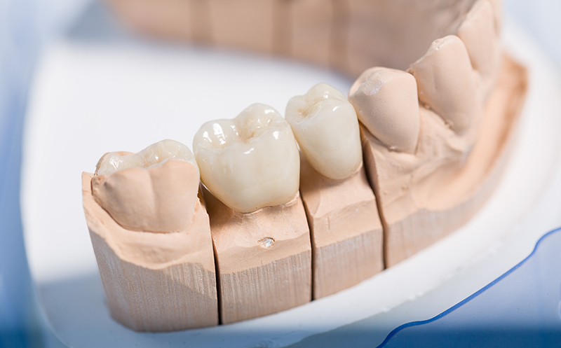 dr-moroni-zahnprothesen