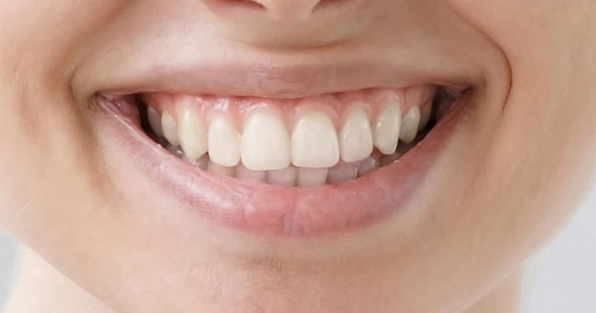 Zahn wird grau kind