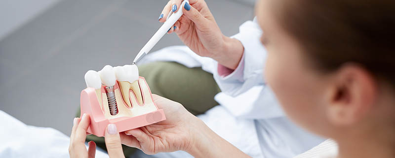Ein Zahnarzt zeigt einem Patienten ein Zahnimplantat-Modell zur Veranschaulichung des Aufbaus und der Platzierung im Kiefer.